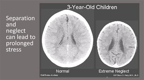 czech twins 8|Developmental Psychology: Emotional deprivation .